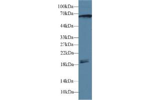 Detection of CAMK2g in Rat Cerebrum lysate using Polyclonal Antibody to Calcium/Calmodulin Dependent Protein Kinase II Gamma (CAMK2g) (CAMKII gamma Antikörper  (AA 6-208))