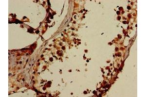 Immunohistochemistry of paraffin-embedded human testis tissue using ABIN7151564 at dilution of 1:100 (ELOVL4 Antikörper  (AA 270-314))