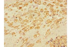 Immunohistochemistry of paraffin-embedded human placental tissue using ABIN7150164 at dilution of 1:100 (Retinoblastoma Binding Protein 8 Antikörper  (AA 126-331))