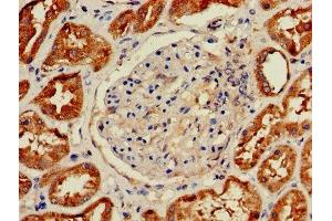 Immunohistochemistry of paraffin-embedded human kidney tissue using ABIN7155369 at dilution of 1:100 (HIST2H2AC Antikörper  (AA 2-129))