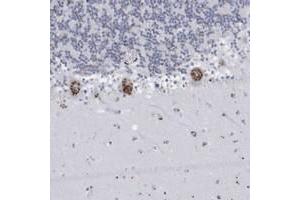 Immunohistochemical staining of human cerebellum with FAM207A polyclonal antibody  shows strong cytoplasmic positivity(granular pattern) in Purkinje cells at 1:200-1:500 dilution. (FAM207A Antikörper)