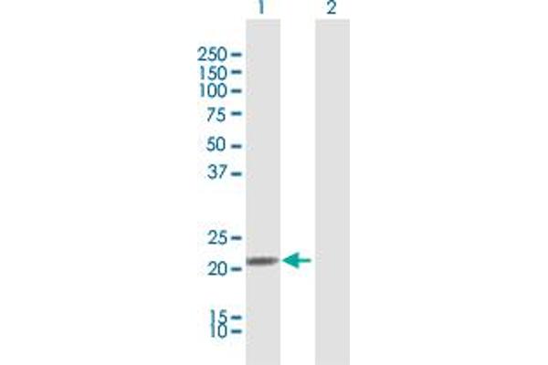 IFNA21 Antikörper  (AA 1-189)