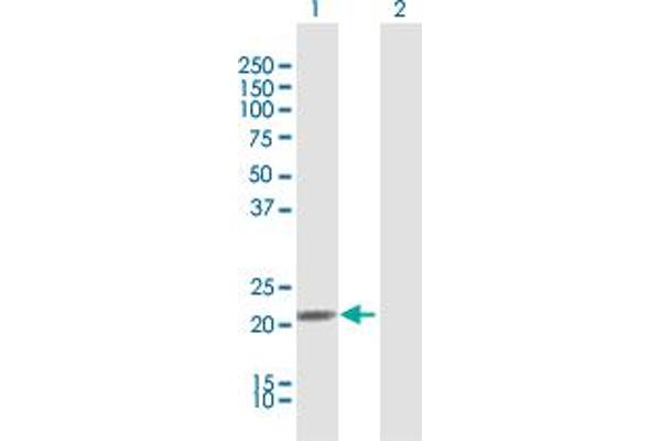 IFNA21 antibody  (AA 1-189)