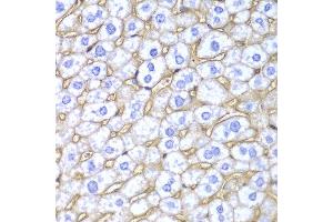 Immunohistochemistry of paraffin-embedded mouse liver using HLA-A antibody at dilution of 1:100 (400x lens).