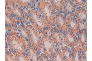 Immunohistochemistry (IHC) image for anti-Interleukin 11 Receptor, alpha (IL11RA) (AA 194-329) antibody (ABIN7438169)