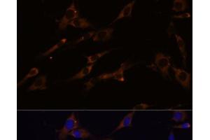 Immunofluorescence analysis of C6 cells using RPL7A Polyclonal Antibody at dilution of 1:100 (40x lens). (RPL7A Antikörper)
