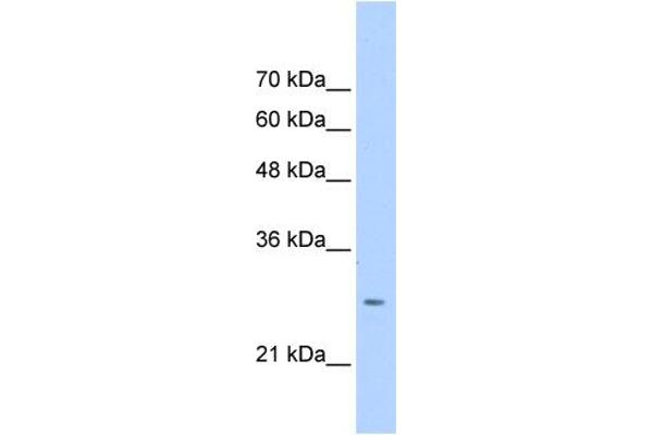 Aspartate beta Hydroxylase Antikörper  (N-Term)