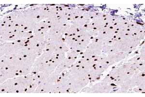 ABIN6267590 at 1/200 staining human Smooth muscle tissue sections by IHC-P.