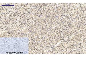 Immunohistochemical analysis of paraffin-embedded human uterus tissue. (TGFB1 Antikörper  (AA 310-390))