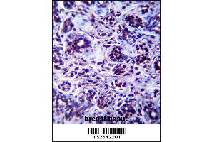 DHX32 Antibody immunohistochemistry analysis in formalin fixed and paraffin embedded human breast tissue followed by peroxidase conjugation of the secondary antibody and DAB staining.