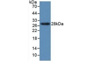 Detection of Recombinant PTHrP, Human using Monoclonal Antibody to Parathyroid Hormone Related Protein (PTHrP)