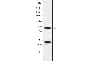 Western blot analysis of APOBEC3A/B using HuvEc whole cell lysates (APOBEC3A/B Antikörper)
