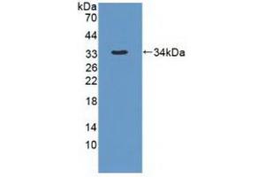 Figure. (DYNC1H1 Antikörper  (AA 20-285))