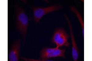 Immunofluorescence (IF) image for anti-Ribosomal Protein S6 (RPS6) (pSer235) antibody (ABIN7138498)