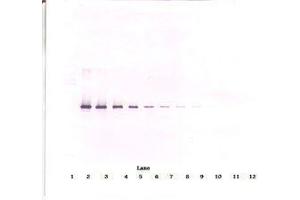 Image no. 1 for anti-serpin Peptidase Inhibitor, Clade I (neuroserpin), Member 1 (SERPINI1) antibody (ABIN465664) (Neuroserpin Antikörper)
