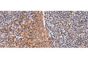 Immunohistochemistry of paraffin-embedded Human tonsil tissue using ACYP1 Polyclonal Antibody at dilution of 1:65(x200)