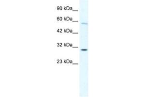 Western Blotting (WB) image for anti-GATA Zinc Finger Domain Containing 1 (GATAD1) antibody (ABIN2460670)