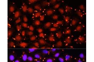 Immunofluorescence analysis of HeLa cells using ACAA1 Polyclonal Antibody at dilution of 1:100 (40x lens). (ACAA1 Antikörper)