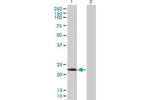 Western Blot analysis of DYDC2 expression in transfected 293T cell line by DYDC2 MaxPab polyclonal antibody. (DYDC2 Antikörper  (AA 1-177))