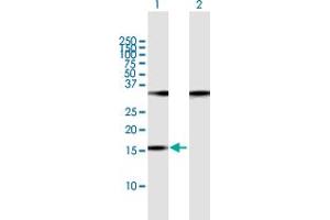 Western Blot analysis of POP7 expression in transfected 293T cell line by POP7 MaxPab polyclonal antibody.