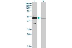 Western Blot analysis of MKRN2 expression in transfected 293T cell line by MKRN2 monoclonal antibody (M01), clone 5F8. (MKRN2 Antikörper  (AA 317-415))