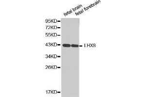 Western blot analysis of extracts of various cell lines, using LHX8antibody. (LHX8 Antikörper  (AA 1-220))