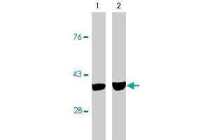 Western blot analysis using CASP7 monoclonal antibody, clone MCH3-5  on MCF-7 cells treated with thapsigargin for 48 hours which are negative (lane 1) and positive (lane 2) for caspase-3. (Caspase 7 Antikörper)