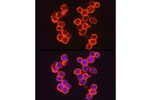 Immunofluorescence analysis of  cells using THBD Rabbit pAb (ABIN1683026, ABIN3018621, ABIN3018622 and ABIN6220518) at dilution of 1:50 (40x lens). (Thrombomodulin Antikörper  (AA 200-500))