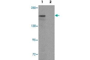 Western blot analysis of ATP2C1 in mouse brain tissue lysate with ATP2C1 polyclonal antibody  at 1 ug/mL in (1) the absence and (2) the presence of blocking peptide. (ATP2C1 Antikörper  (C-Term))