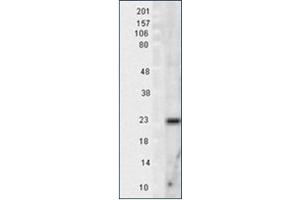 Image no. 1 for anti-Superoxide Dismutase 2, Mitochondrial (SOD2) antibody (ABIN264858) (SOD2 Antikörper)