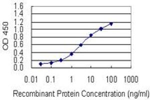 Detection limit for recombinant GST tagged RAI1 is 0. (RAI1 Antikörper  (AA 1-101))