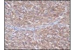 Immunohistochemistry (IHC) image for anti-Mast/stem Cell Growth Factor Receptor (KIT) (C-Term) antibody (ABIN870476) (KIT Antikörper  (C-Term))
