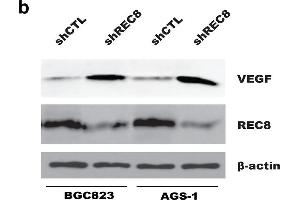 Depletion of REC8 enhanced HUVECs migration and tube formation through upregulation of VEGF in gastric cancer cells. (VEGFA Antikörper  (AA 27-126))