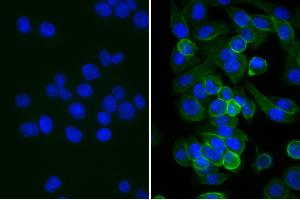 Human pancreatic carcinoma cell line MIA PaCa-2 was stained with Mouse Anti-Human CD44-UNLB, and DAPI. (Kaninchen anti-Maus IgG (Heavy & Light Chain) Antikörper (Alkaline Phosphatase (AP)))