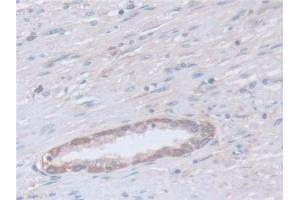 Immunohistochemistry (IHC) image for anti-Calpain, Small Subunit 1 (CAPNS1) (AA 1-268) antibody (ABIN7441262)