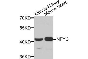 Western blot analysis of extracts of various cell lines, using NFYC antibody.