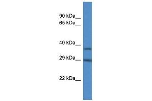 Western Blot showing RAB34 antibody used at a concentration of 1 ug/ml against HepG2 Cell Lysate (RAB34 Antikörper  (C-Term))