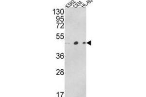 Western Blotting (WB) image for anti-ARP3 Actin-Related Protein 3 Homolog B (ACTR3B) antibody (ABIN3003796) (ACTR3B Antikörper)