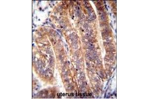 NUMB Antibody (N-term) (ABIN655396 and ABIN2844944) immunohistochemistry analysis in formalin fixed and paraffin embedded human uterus tissue followed by peroxidase conjugation of the secondary antibody and DAB staining. (NUMB Antikörper  (N-Term))