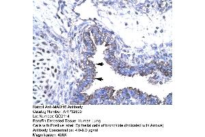 Human Lung (SMAD6 Antikörper  (N-Term))