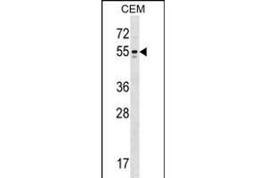 Kv1.6/KCNA6 antibody  (N-Term)
