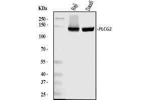 Western blot analysis of PLCG 2/PLCG2 using anti-PLCG 2/PLCG2 antibody (ABIN5692854). (Phospholipase C gamma 2 Antikörper  (AA 1201-1258))