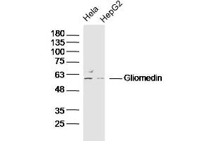Lane 1: Hela lysates Lane 2: HepG2 lysates probed with Gliomedin Polyclonal Antibody, Unconjugated  at 1:300 dilution and 4˚C overnight incubation. (GLDN Antikörper  (AA 365-460))