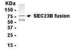 Western Blotting (WB) image for anti-Sec23 Homolog B (SEC23B) (AA 219-530) antibody (ABIN2468160) (Sec23 Homolog B Antikörper  (AA 219-530))