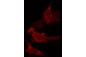 ABIN6275607 staining  HeLa cells by IF/ICC. (SFRS2B Antikörper  (Internal Region))