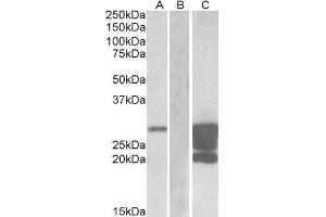 HEK293 lysate (10ug protein in RIPA buffer) overexpressing Human GM2A with DYKDDDDK tag probed with ABIN625813 (1.