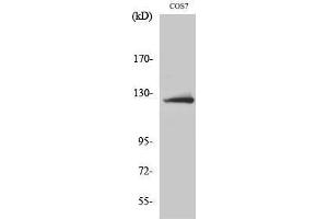 Western Blotting (WB) image for anti-ATP Citrate Lyase (ACLY) (Ser1227) antibody (ABIN3183445) (ACLY Antikörper  (Ser1227))