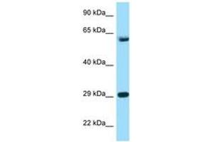 Image no. 1 for anti-T-Complex 1 (TCP1) (AA 471-520) antibody (ABIN6748135)