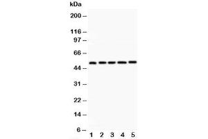 Western blot testing of LXR alpha antibody and Lane 1:  rat liver;  2: rat lung;  3: rat spleen;  4: rat kidney;  5: human placenta;  Predicted size: 51KD;  Observed size: 51KD (NR1H3 Antikörper  (C-Term))