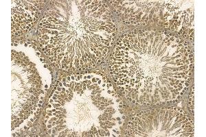 MTBP Mouse Monoclonal Antibody at 1/100 staining rat testis tissue by IHC-P. (MTBP Antikörper)